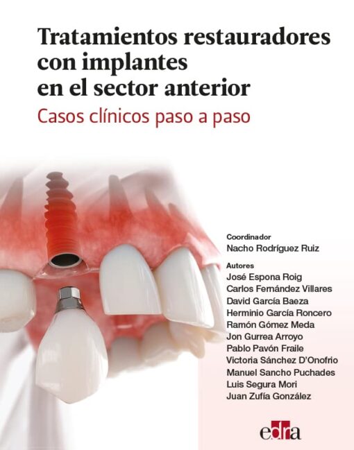 Tratamientos restauradores con implantes en el sector anterior. Casos clínicos paso a paso. (EPUB) Tratamientos restauradores con implantes en el sector anterior. Casos clínicos paso a paso. (EPUB)