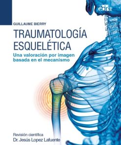 Traumatología esquelética Una valoración por imagen basada en el mecanismo (EPUB)