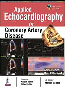 Applied Echocardiography in Coronary Artery Disease (Videos Only)