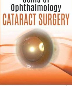 Gems of Ophthalmology—Cataract Surgery (PDF)