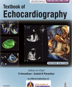 Textbook of Echocardiography, 2nd edition (PDF Book+Videos)