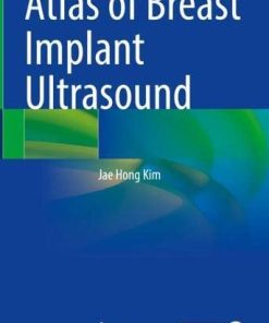 Atlas of Breast Implant Ultrasound (PDF)