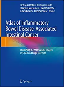 Atlas of Inflammatory Bowel Disease-Associated Intestinal Cancer: Examining the Macroscopic Images of Small and Large Intestine (EPUB)