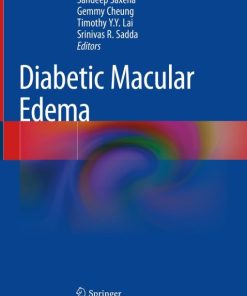 Diabetic Macular Edema (EPUB)