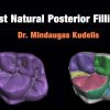 Fast Natural Posterior Fillings