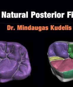 Fast Natural Posterior Fillings