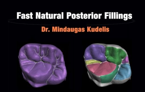 Fast Natural Posterior Fillings