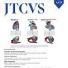 The Journal of Thoracic and Cardiovascular Surgery: Volume 165 (Issue 1 to Issue 6) 2023 PDF