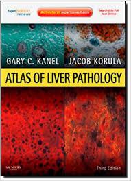 Atlas of Liver Pathology: Expert Consult