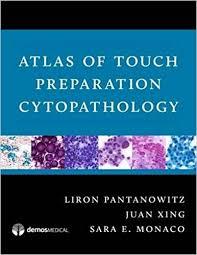 Atlas of Touch Preparation Cytopathology 1st