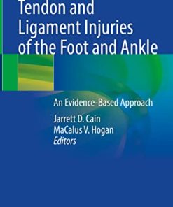 Tendon and Ligament Injuries of the Foot and Ankle: An Evidence-Based Approach (EPUB)
