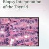 Biopsy Interpretation of the Thyroid (Biopsy Interpretation Series) 1 Har/Psc Edition