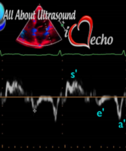 Mastering Left Ventricular Diastology – AllAboutUltrasound 2022 (Complete HTML)