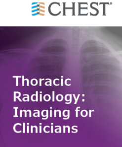 Thoracic Radiology: Imaging for Clinicians (Chestnet) 2021 (Videos + Quiz)