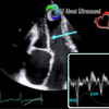 Mastering Constrictive Pericarditis – AllAboutUltrasound 2022 (Complete HTML)