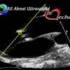 Mastering Aortic Stenosis – AllAboutUltrasound 2022 (Complete HTML)