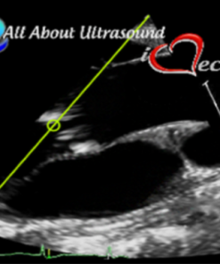 Mastering Aortic Stenosis – AllAboutUltrasound 2022 (Complete HTML)