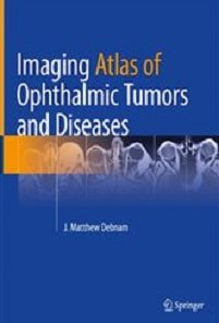 Imaging Atlas of Ophthalmic Tumors and Diseases (EPUB)