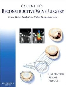 Carpentier’s Reconstructive Valve Surgery, 1e (PDF)