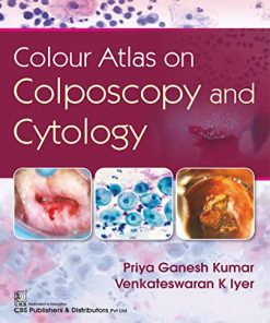 Colour Atlas on Colposcpoy and Cytology Kindle Edition