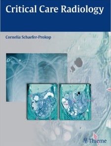 Critical Care Radiology (Thieme) (PDF)