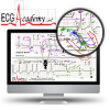 ECG Academy: Advanced Level Video Lecture Course-Videos