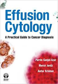 Effusion Cytology: A Practical Guide to Cancer Diagnosis First Edition