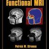 Essentials of Functional MRI