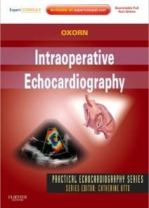 Intraoperative Echocardiography: Expert Consult: Online and Print, 1e (Practical Echocardiography) 1 Har/Psc Edition) (PDF)