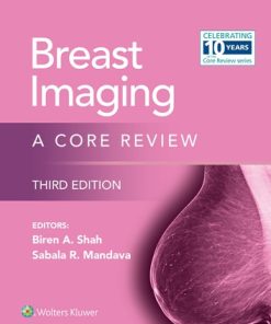 Breast Imaging (EPUB)