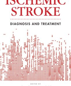 Ischemic Stroke: Diagnosis and Treatment (PDF)