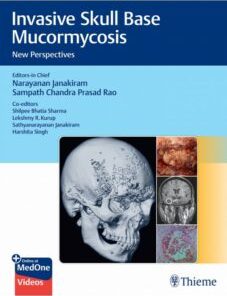 Invasive Skull Base Mucormycosis New Perspectives (PDF Book+Videos)