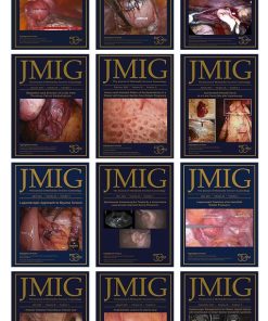 Journal of Minimally Invasive Gynecology 2021 Full Archives (PDF)