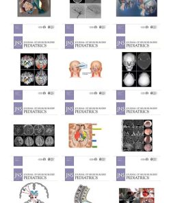 Journal of Neurosurgery: Pediatrics 2022 Full Archives (PDF)