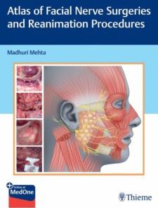 Atlas of Facial Nerve Surgeries and Reanimation Procedures (PDF)