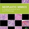 Neoplastic Mimics in Gastrointestinal and Liver Pathology (Pathology of Neoplastic Mimics) 1st Edition