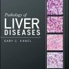 Pathology of Liver Diseases 1st