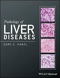 Pathology of Liver Diseases 1st