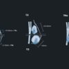 MRIOnline Mastery Series: Evaluation of Newly Diagnosed, Pre-Operative Breast Cancer Patients 2021 (CME VIDEOS)