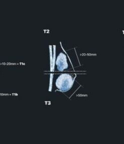 MRIOnline Mastery Series: Evaluation of Newly Diagnosed, Pre-Operative Breast Cancer Patients 2021 (CME VIDEOS)