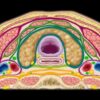 MRIOnline Mastery Series: The Carotid Space 2021 (CME VIDEOS)