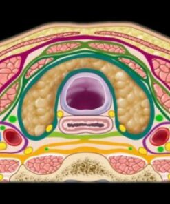 MRIOnline Mastery Series: The Carotid Space 2021 (CME VIDEOS)