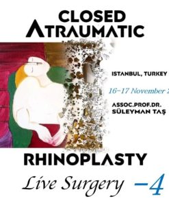 Closed Atraumatic Rhinoplasty Live Surgery DVD 4 / Digital