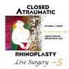 Closed Atraumatic Rhinoplasty Live Surgery DVD 5 / Digital