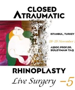 Closed Atraumatic Rhinoplasty Live Surgery DVD 5 / Digital