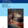 Spinal Deformity Surgery Tips from the Masters (PDF)