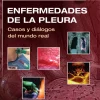 Enfermedades de la pleura Casos y diálogos del mundo real (PDF)