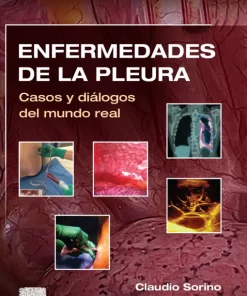 Enfermedades de la pleura Casos y diálogos del mundo real (PDF)