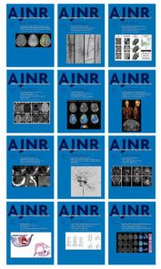 American journal of Neuroradiology 2022 Full Archives (PDF)