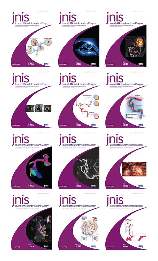 Journal of NeuroInterventional Surgery 2022 Full Archives (PDF)